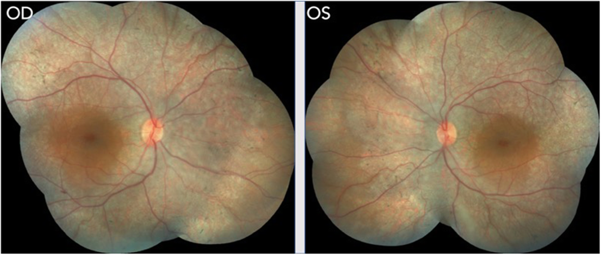 Fig. 4