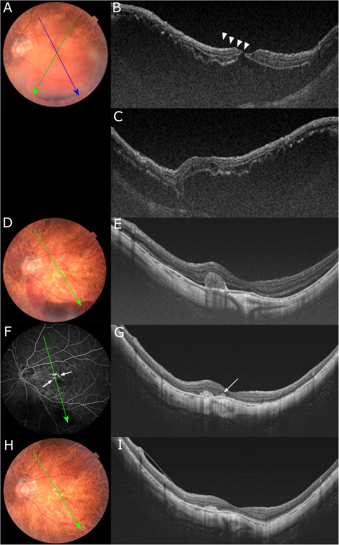 Fig. 3