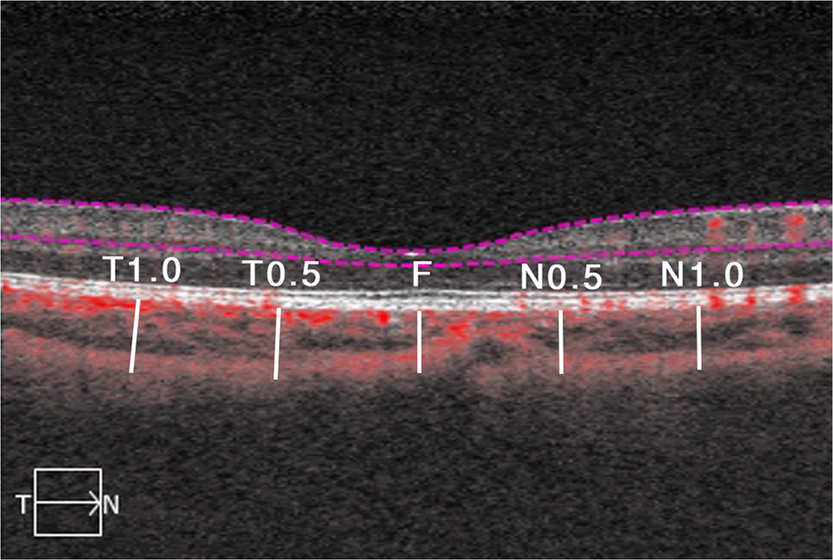 Fig. 4