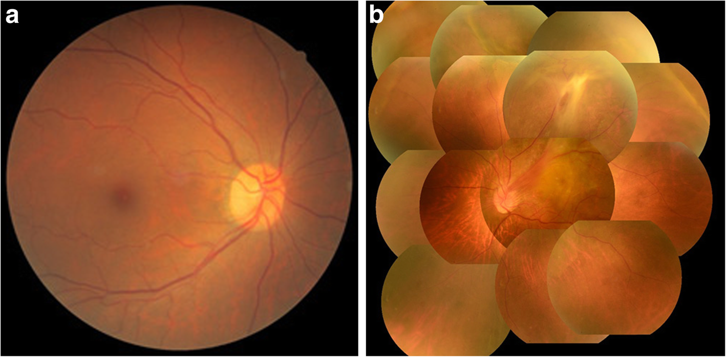 Fig. 1