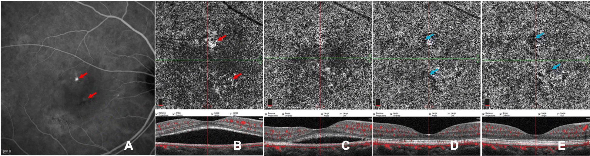 Fig. 3