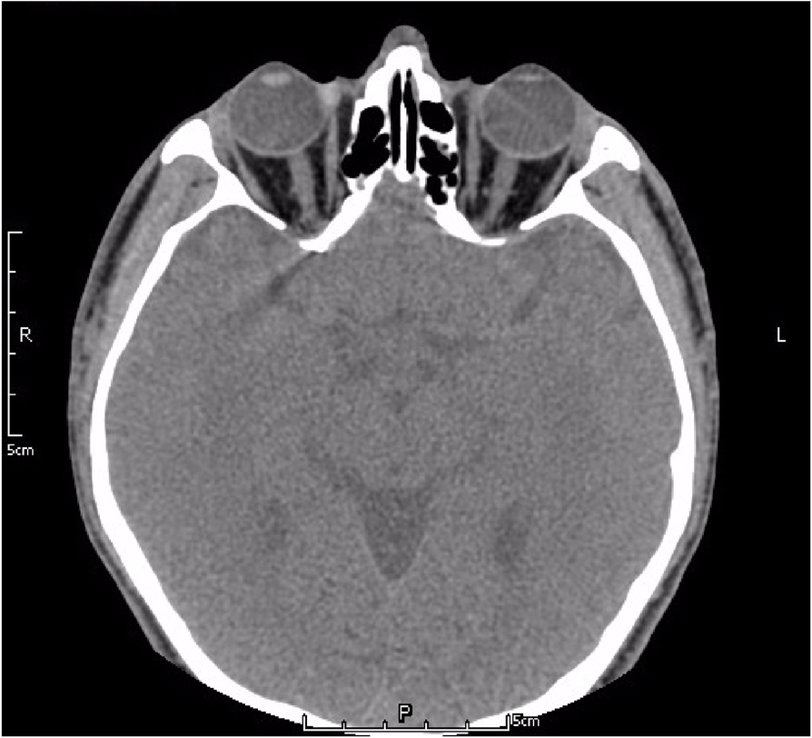 Fig. 8