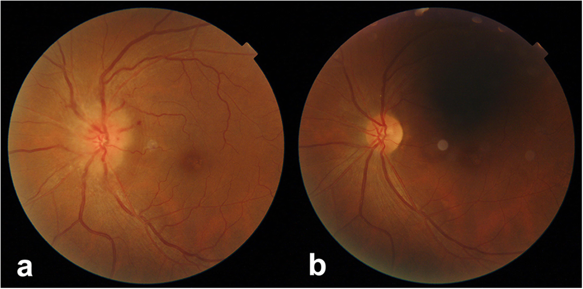 Fig. 2