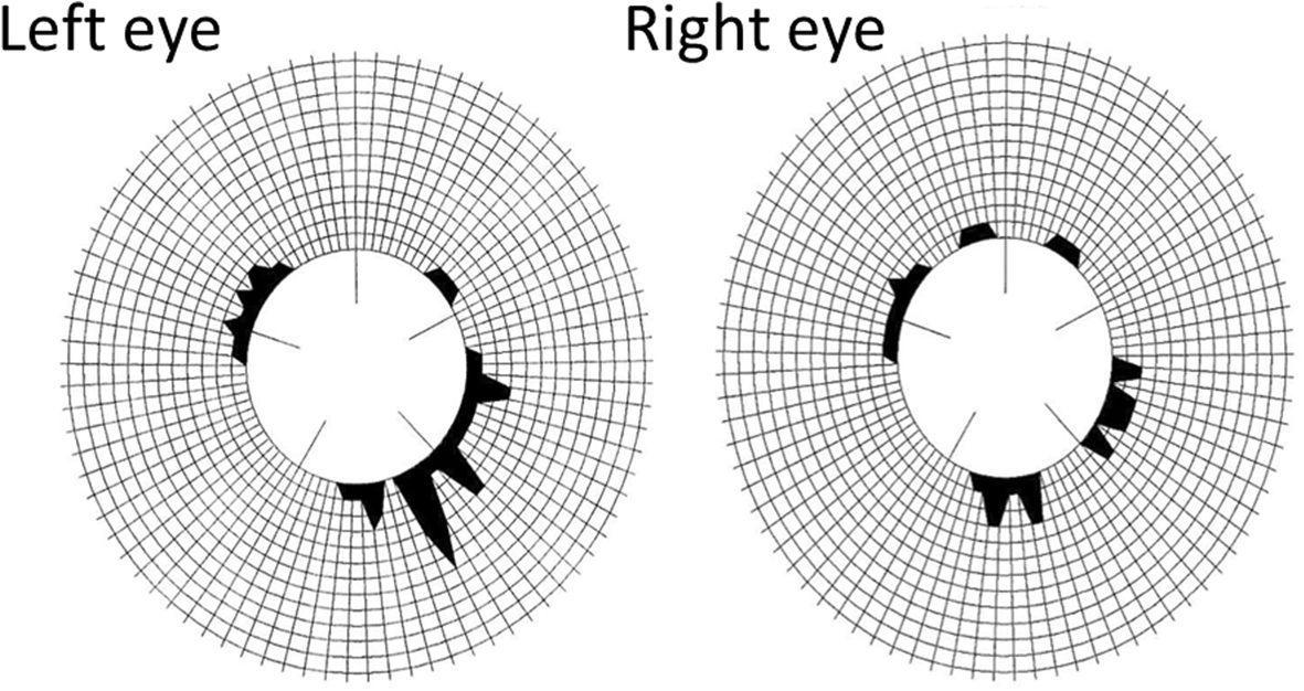 Fig. 1