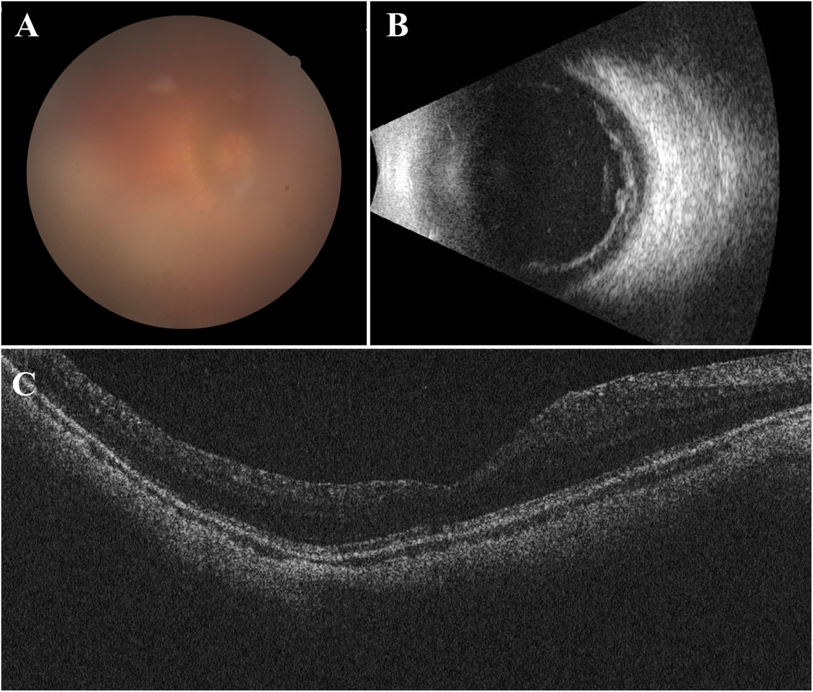 Fig. 1