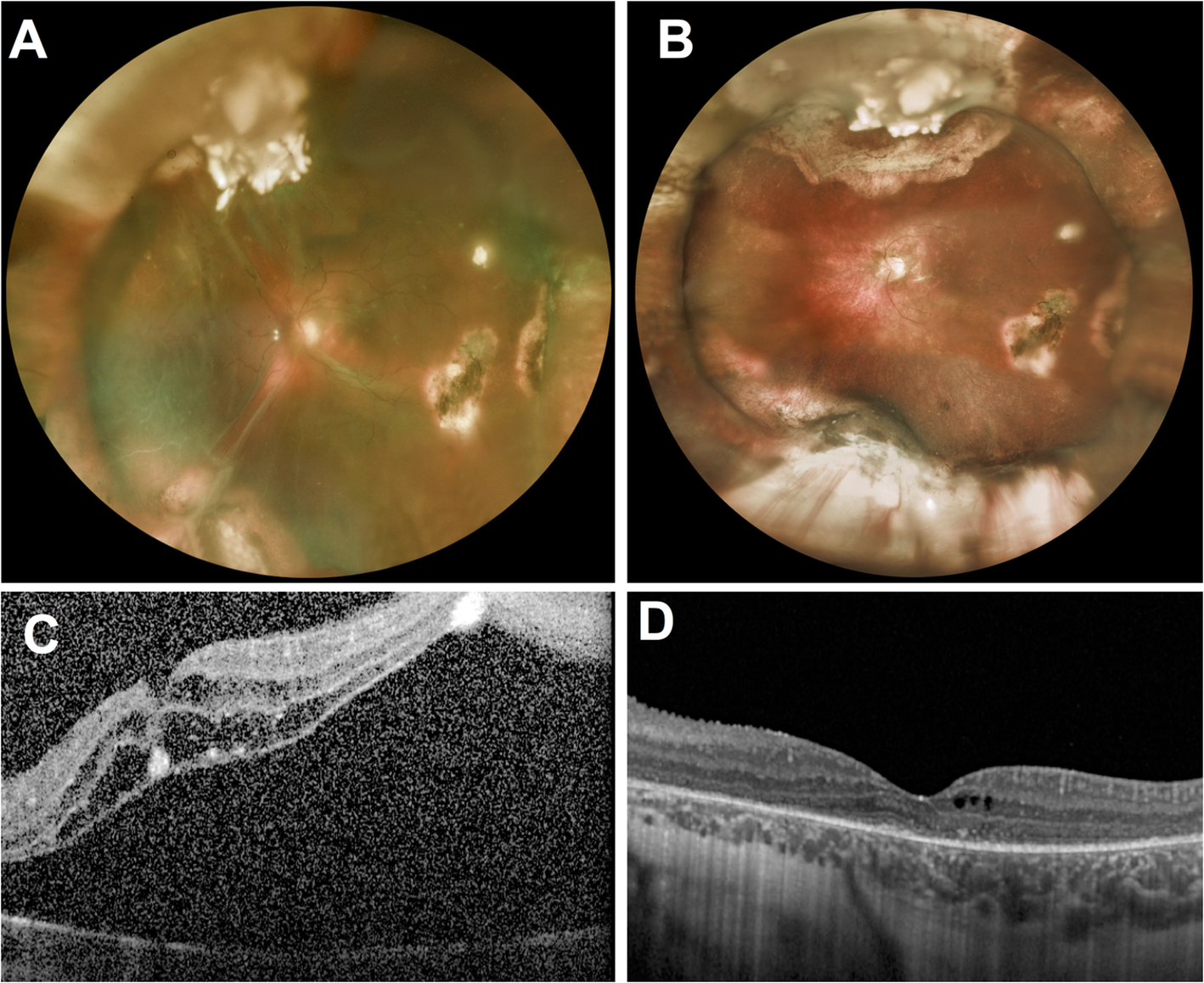 Fig. 1