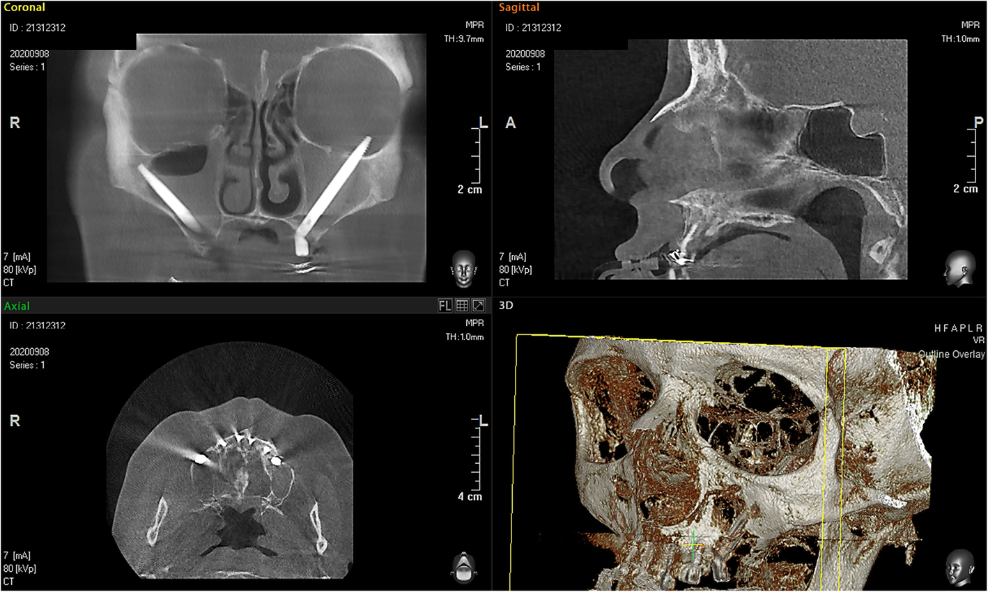 Fig. 2