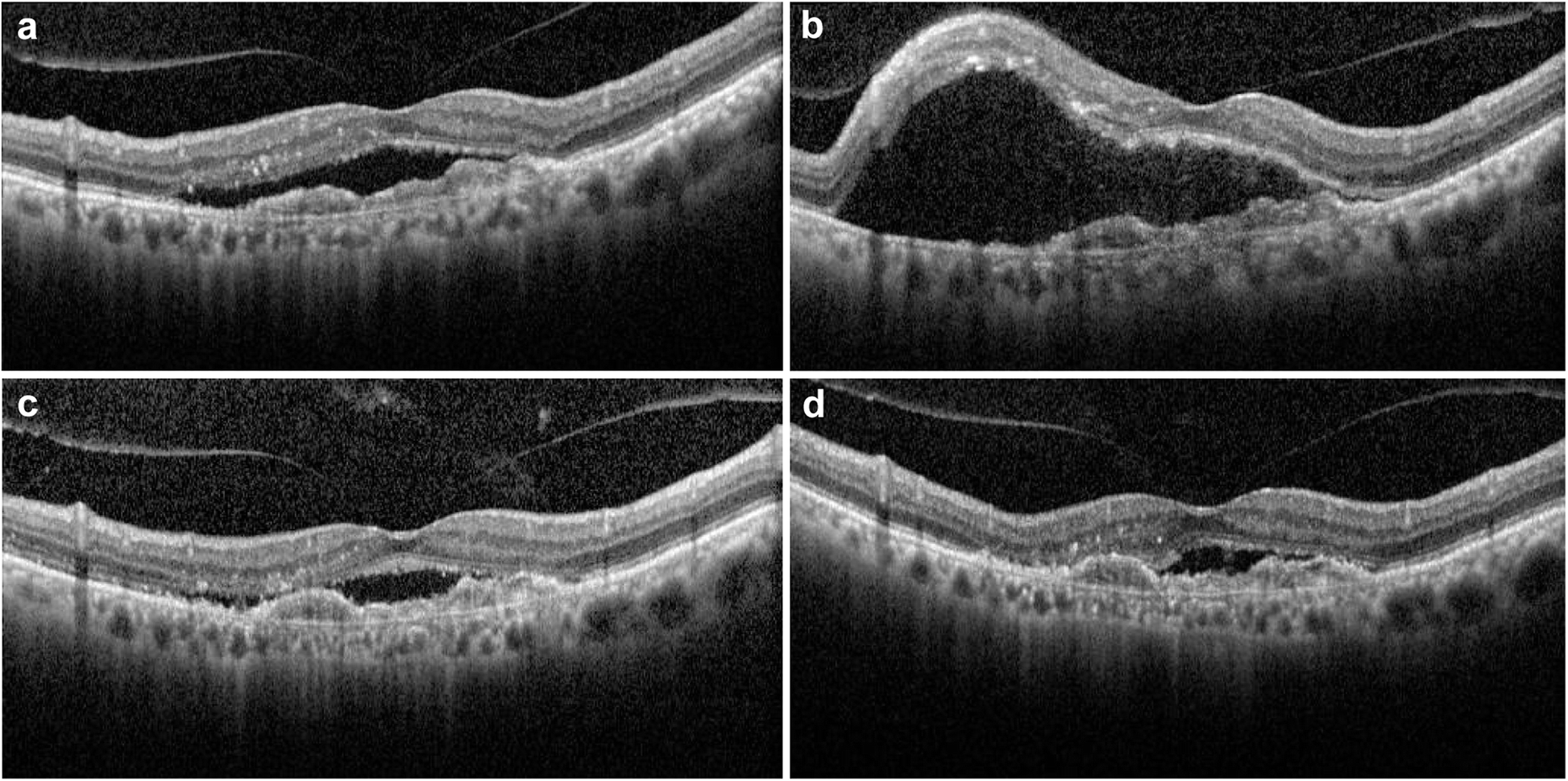 Fig. 2