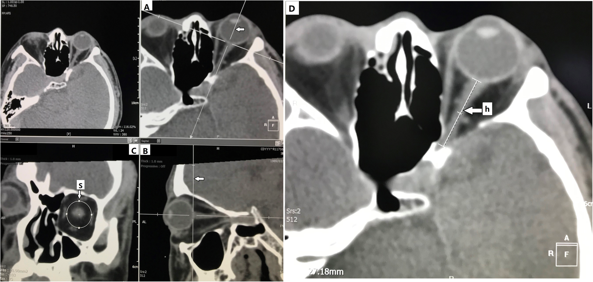 Fig. 3