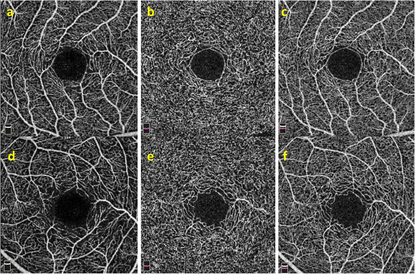 Fig. 4