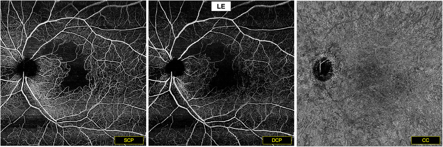 Fig. 6