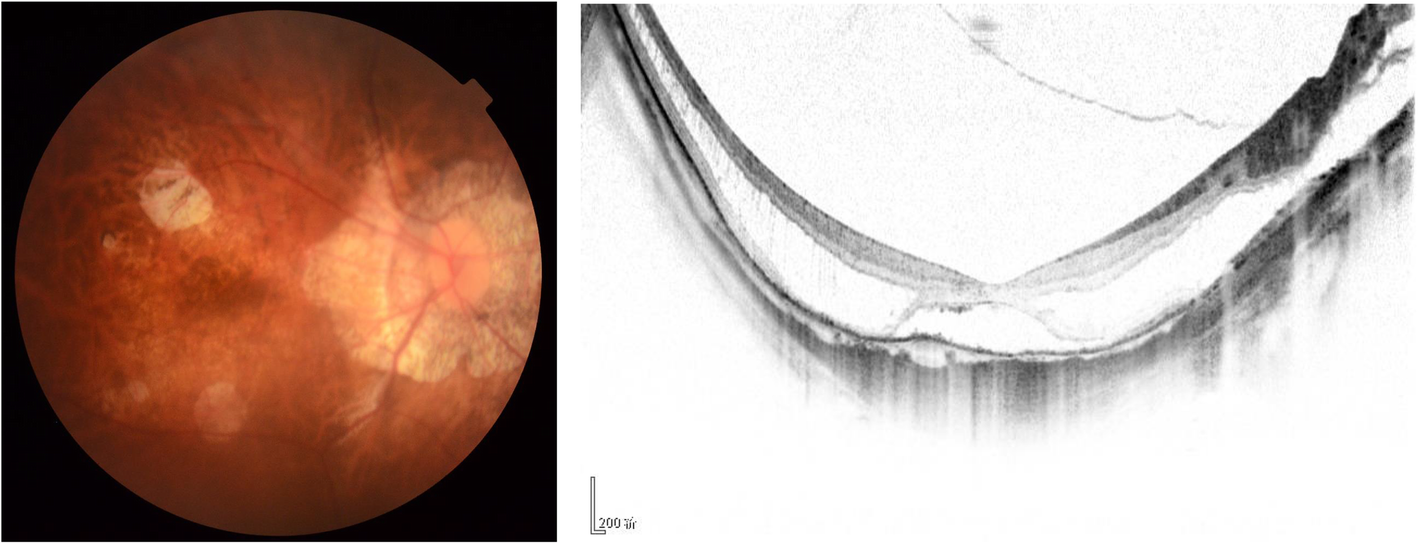 Fig. 1