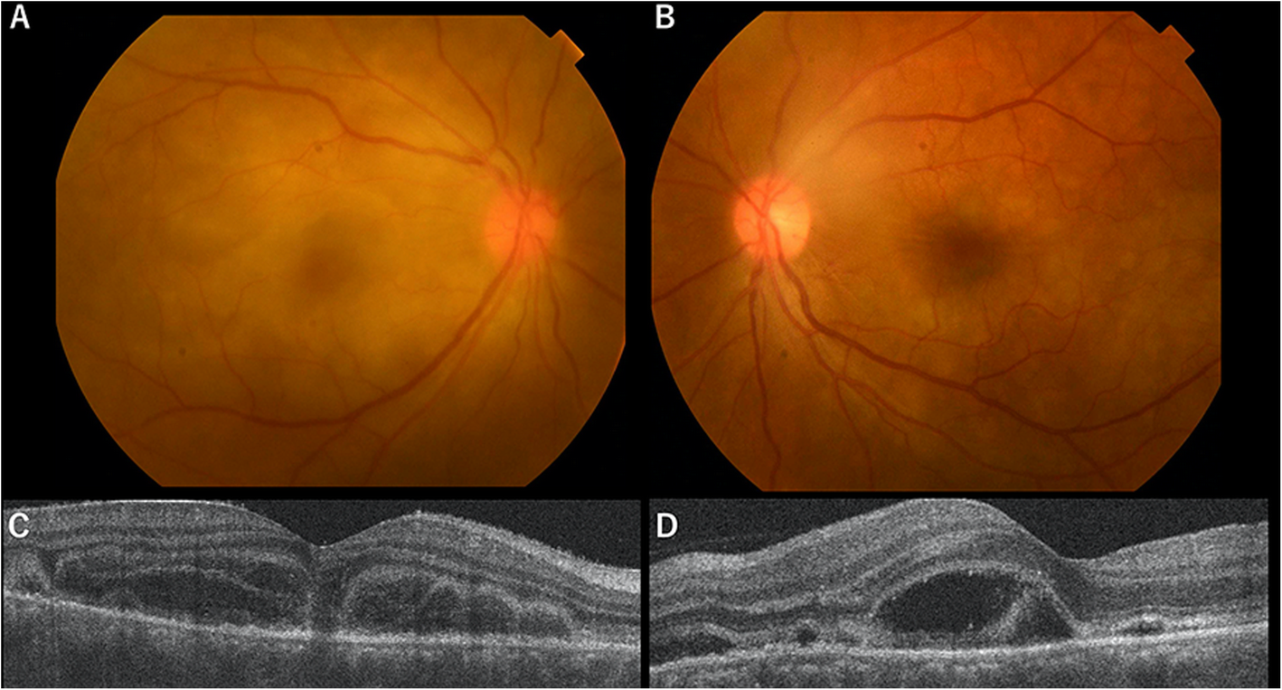 Fig. 1