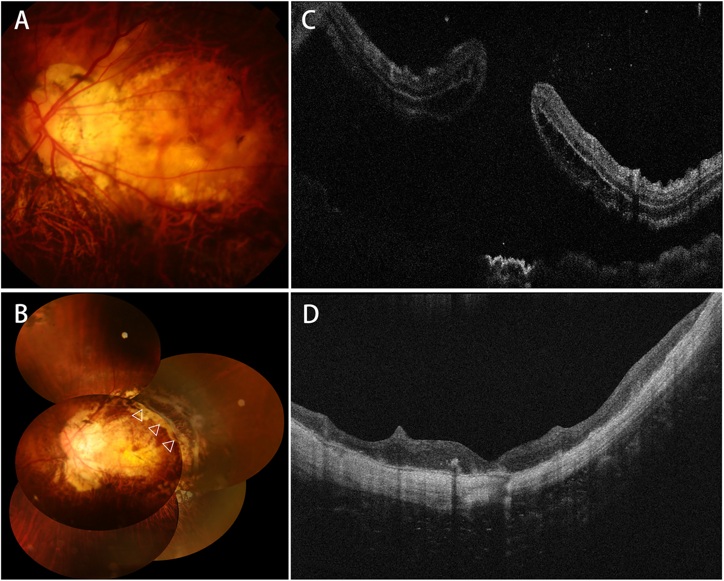 Fig. 1