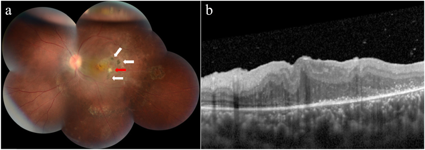 Fig. 2