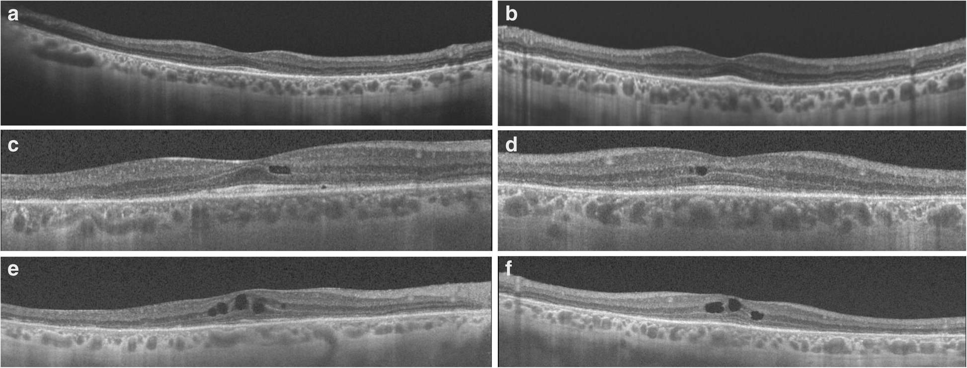 Fig. 4