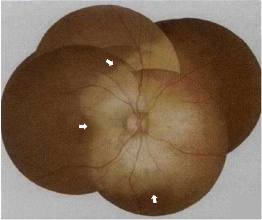 Fig. 1