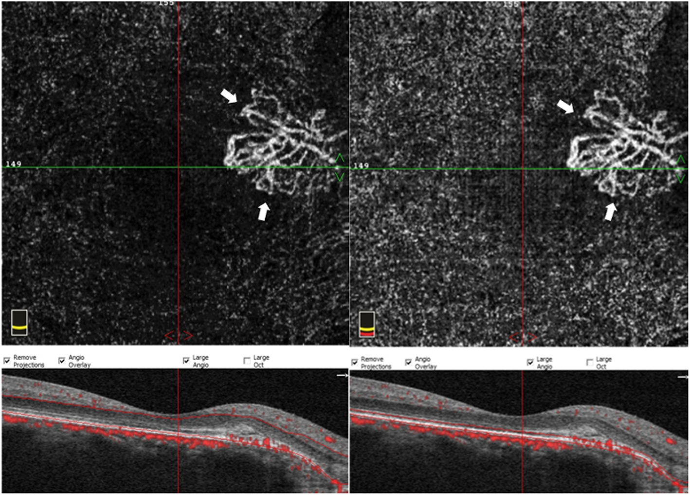 Fig. 9