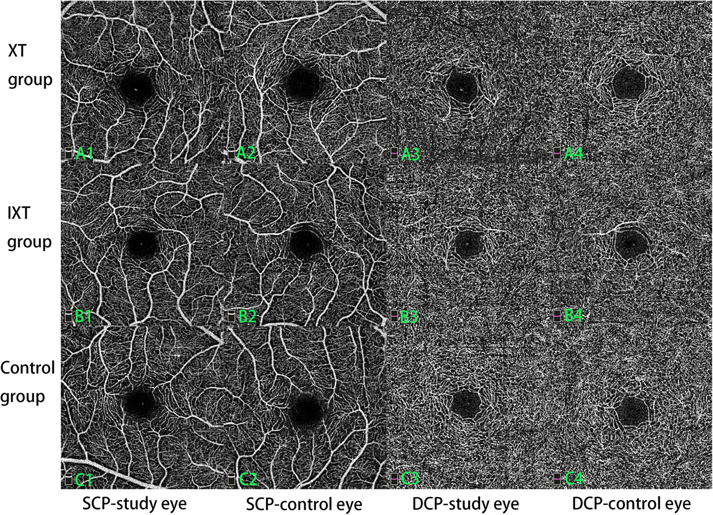 Fig. 1 