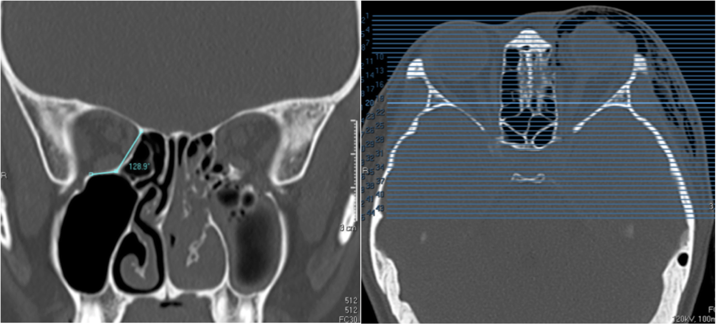 Fig. 6