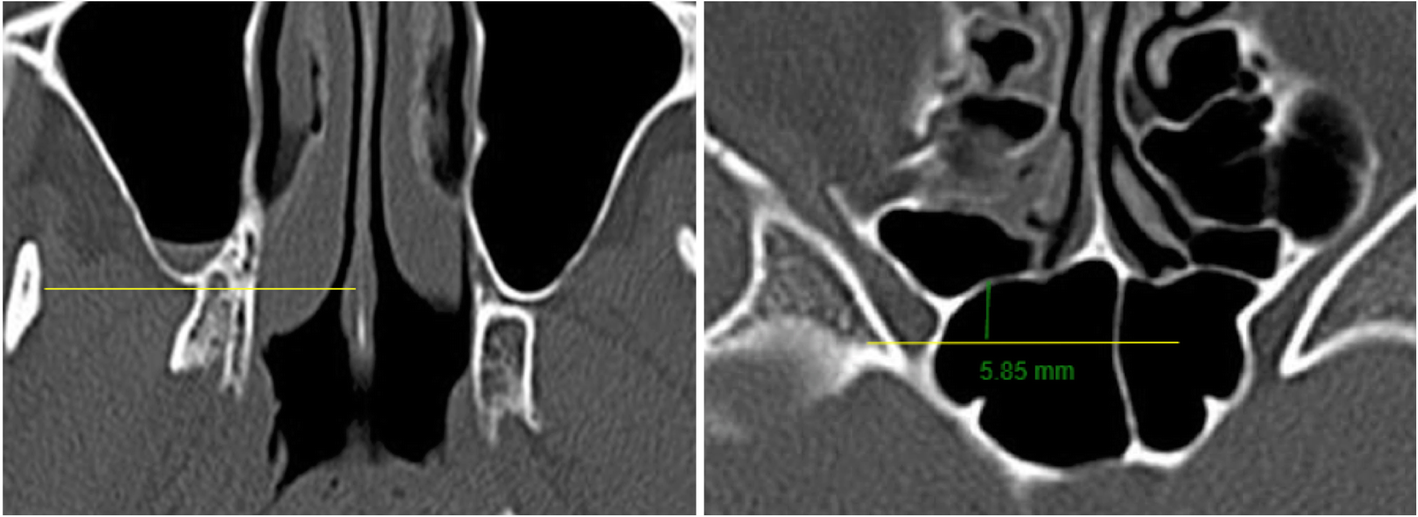 Fig. 8