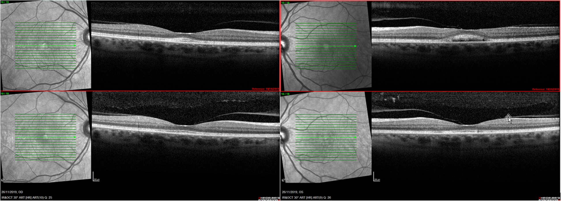 Fig. 7