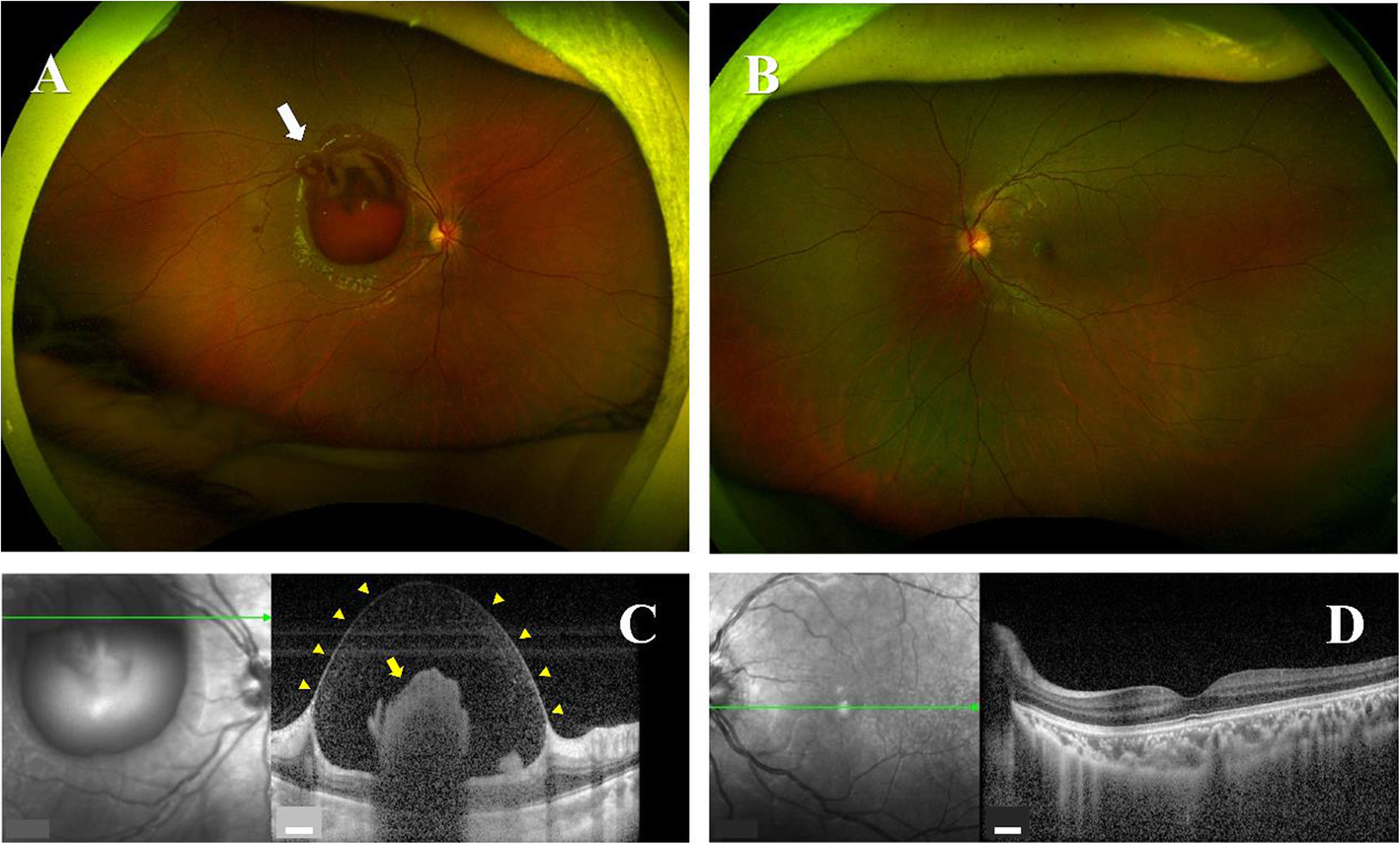 Fig. 1