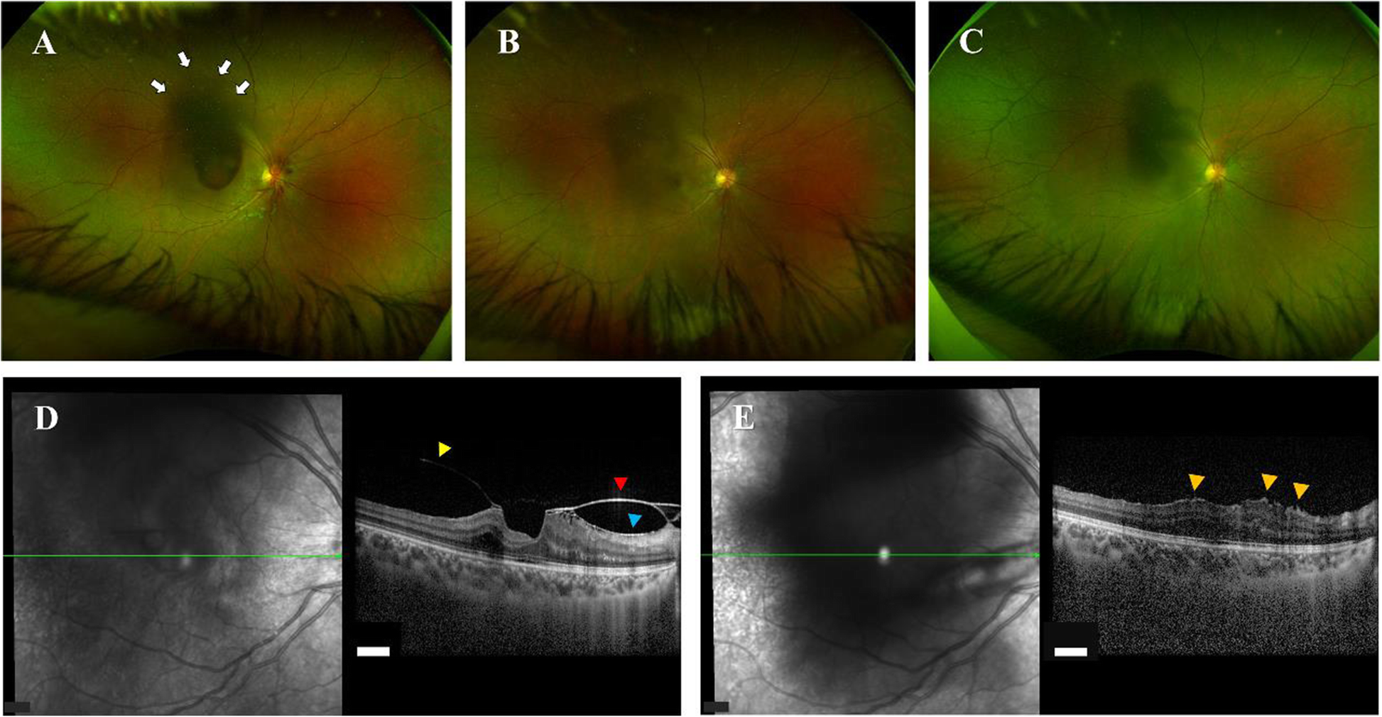 Fig. 4