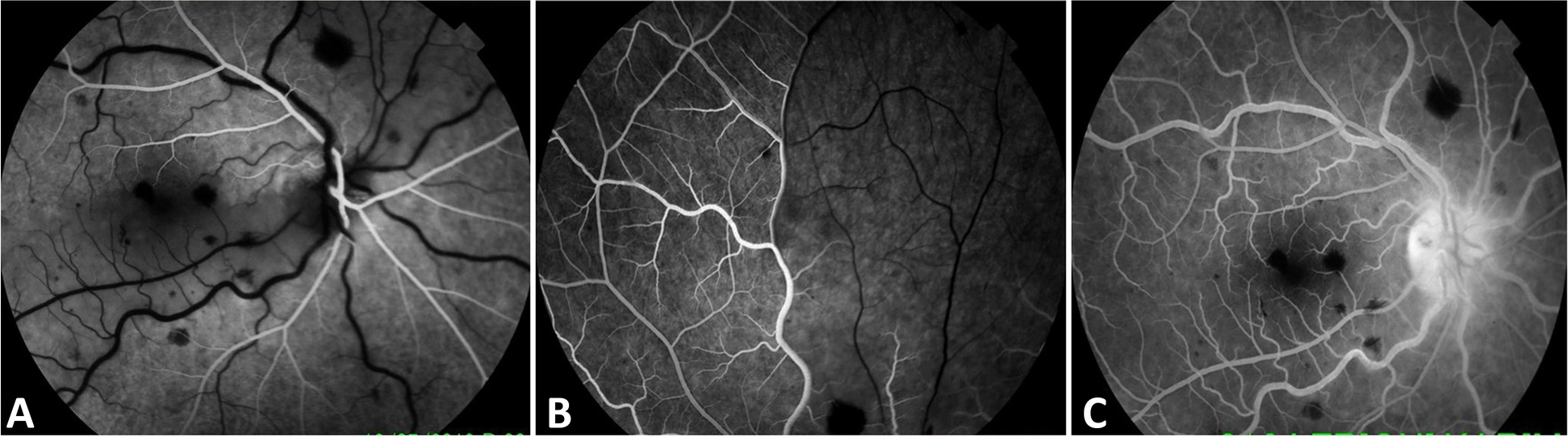 Fig. 2