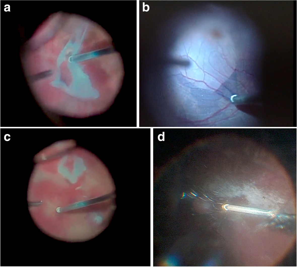 Fig. 2