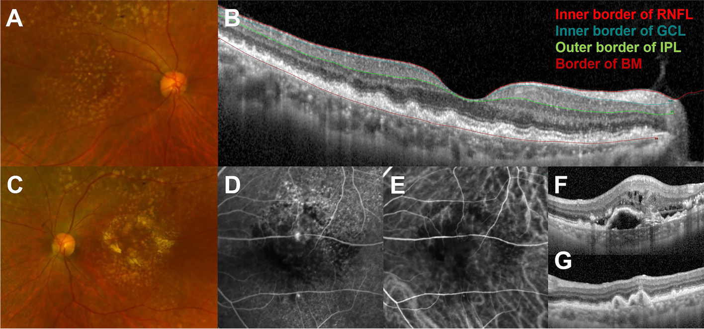 Fig 6.