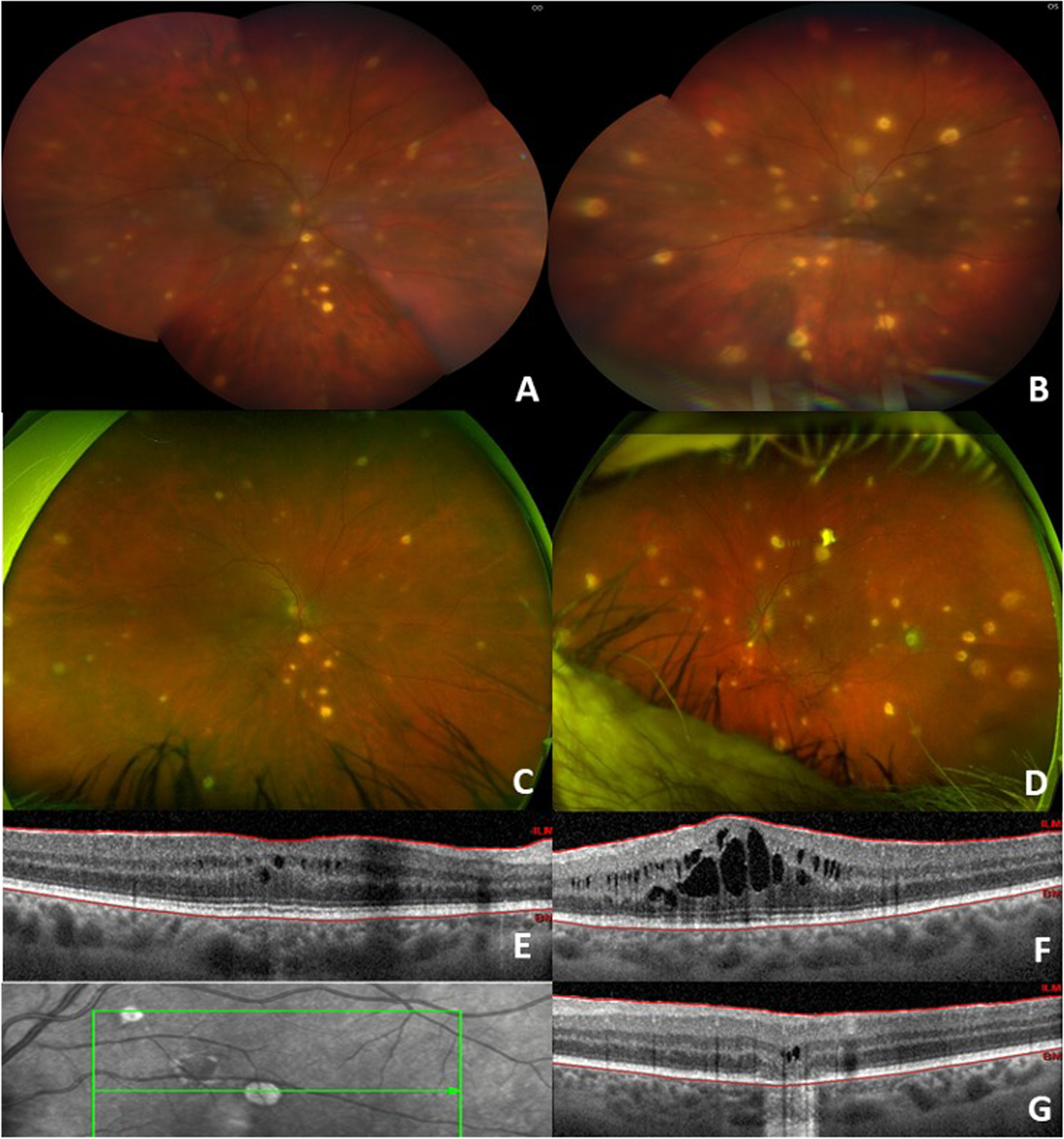 Fig. 1