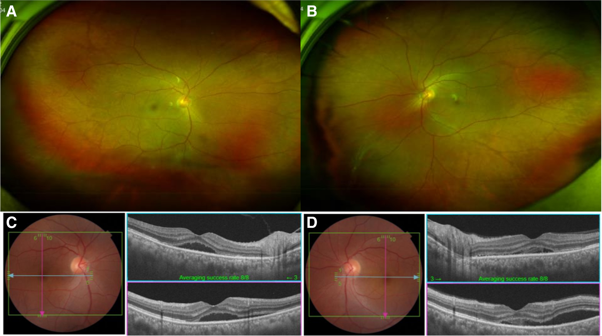 Fig. 3