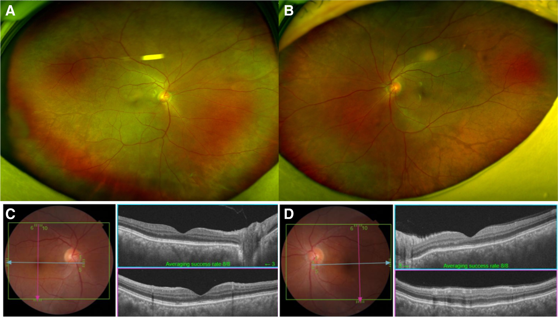 Fig. 4