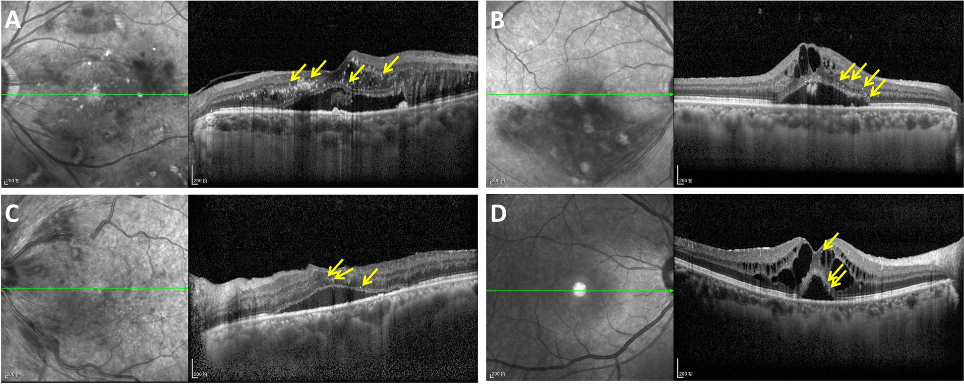 Fig. 3