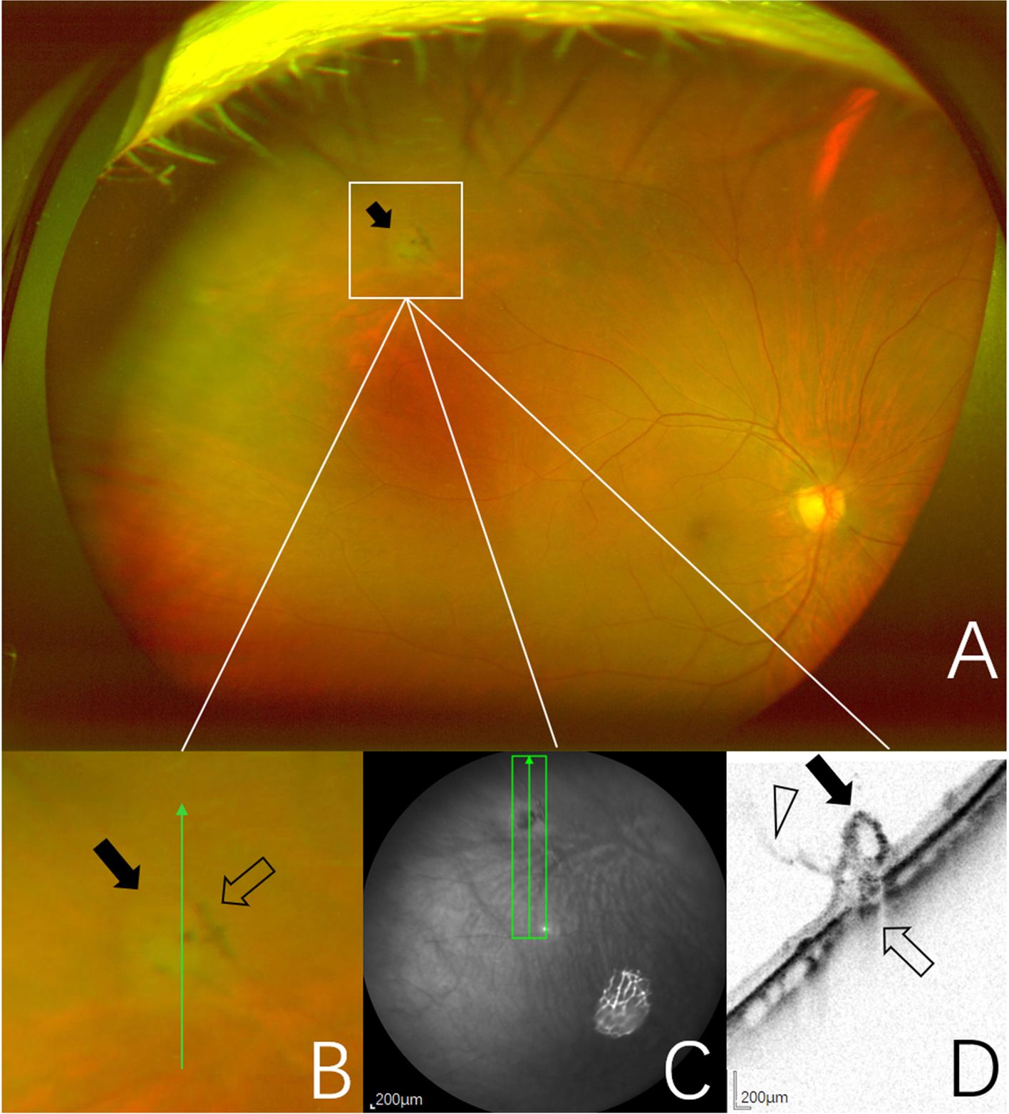 Fig. 2