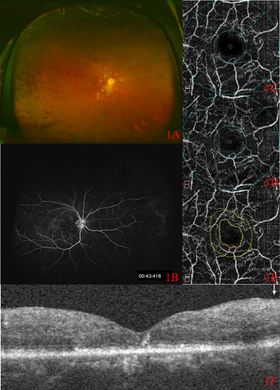 Fig. 1