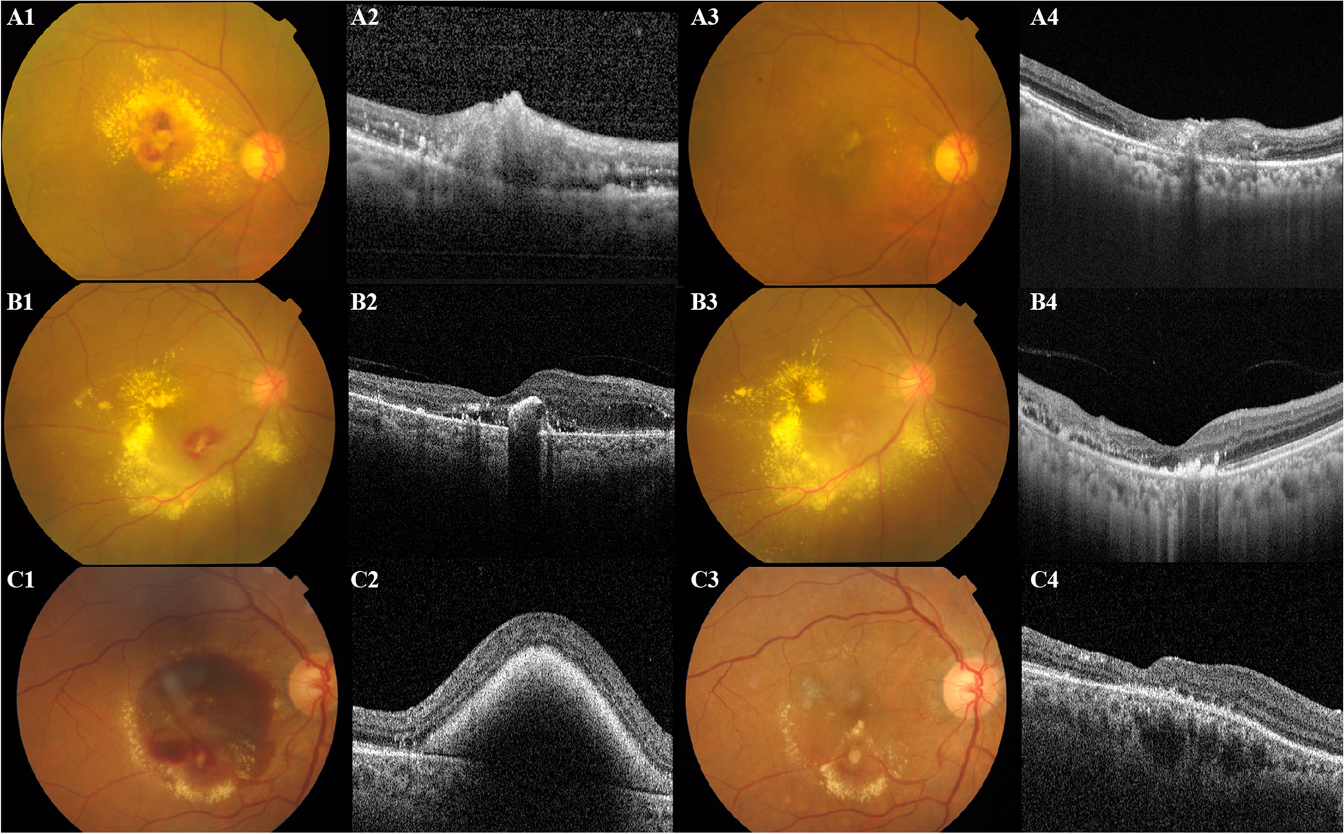 Fig. 1