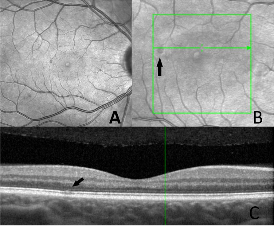 Fig. 2