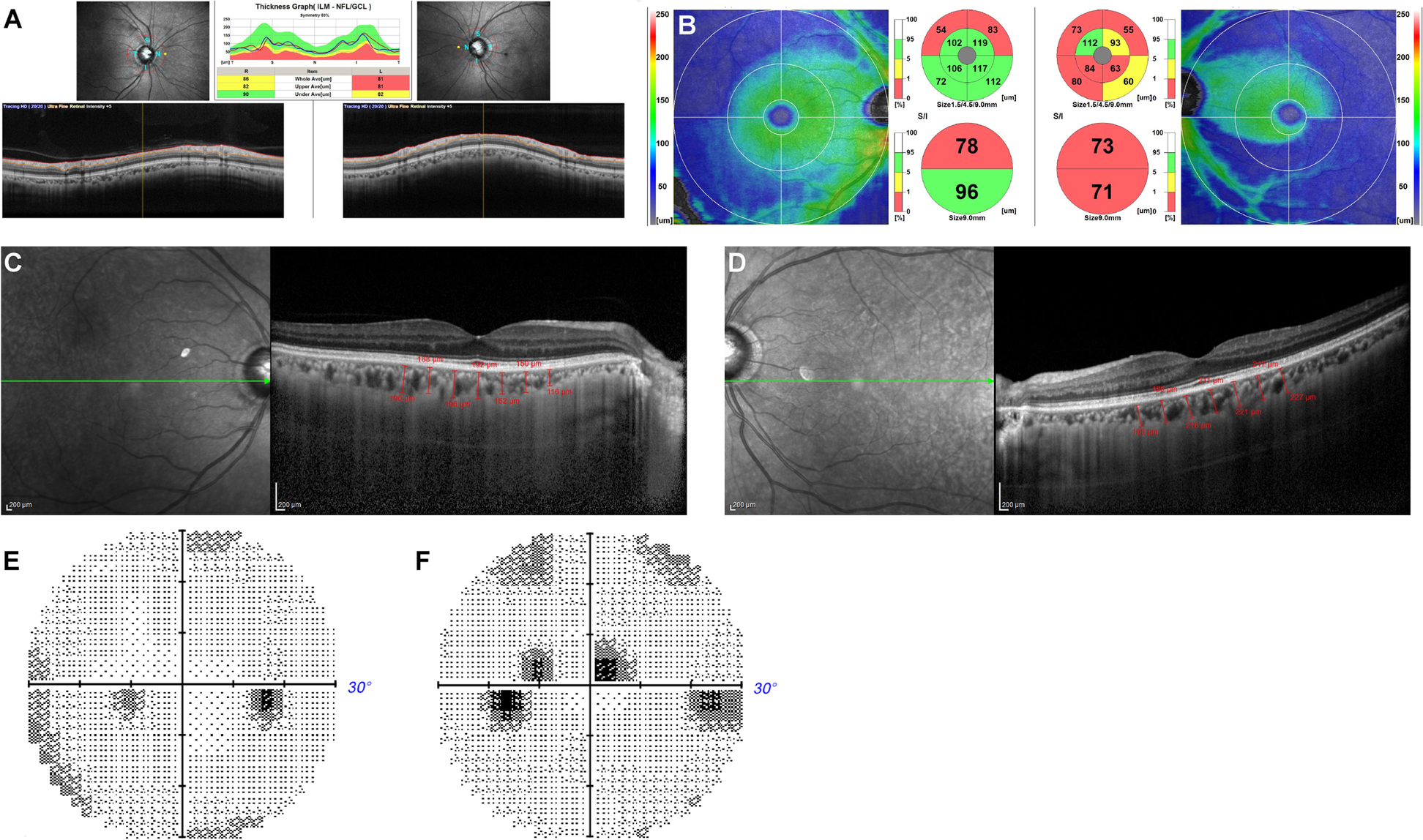 Fig. 2