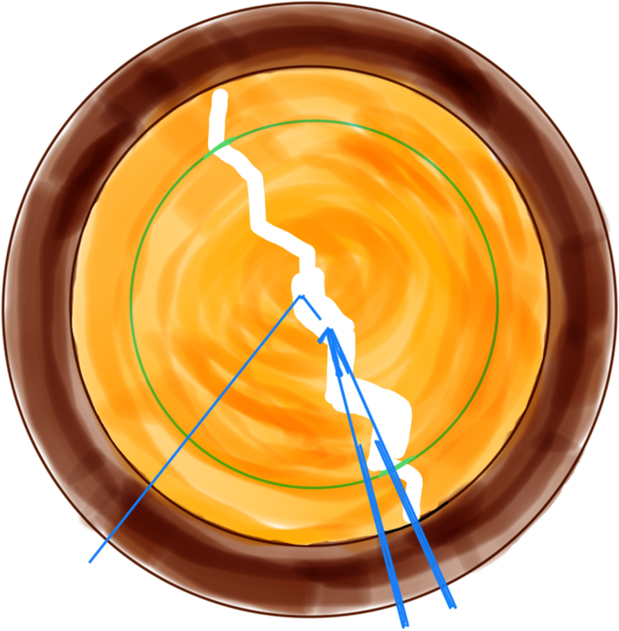 Fig. 5