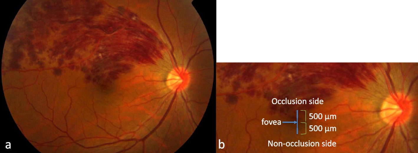 Fig. 1