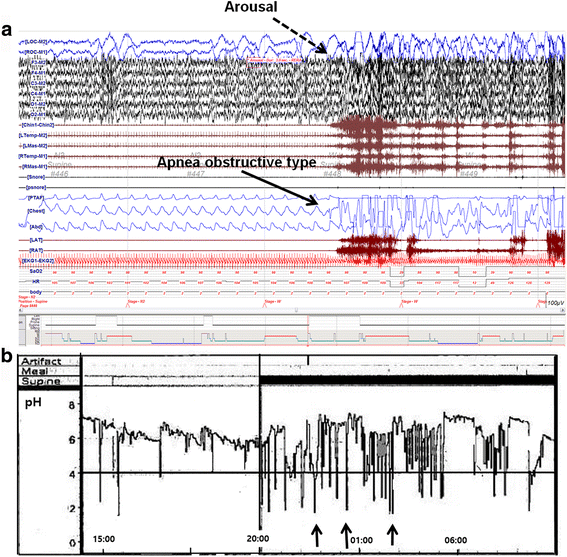 Fig. 2