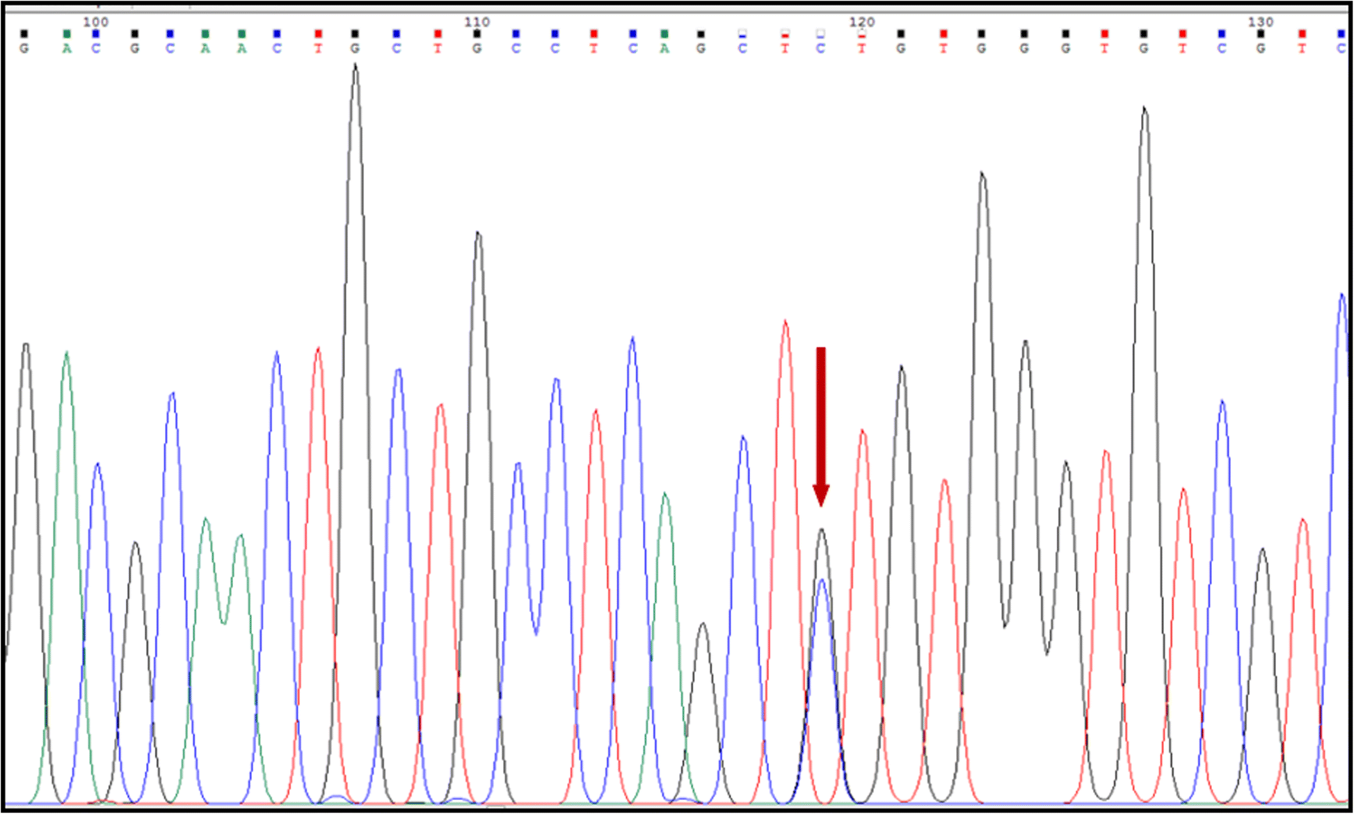 Nrg1 Variant Effects In Patients With Hirschsprung Disease Bmc Pediatrics Full Text Nrg1 Variant Effects In Patients With Hirschsprung Disease Bmc Pediatrics Full Text