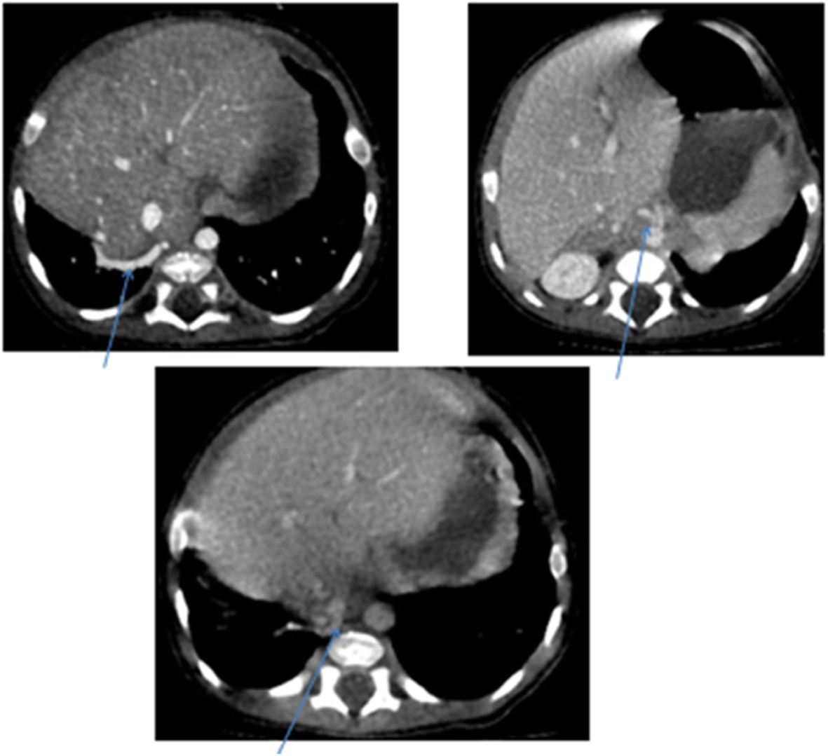 Fig. 10