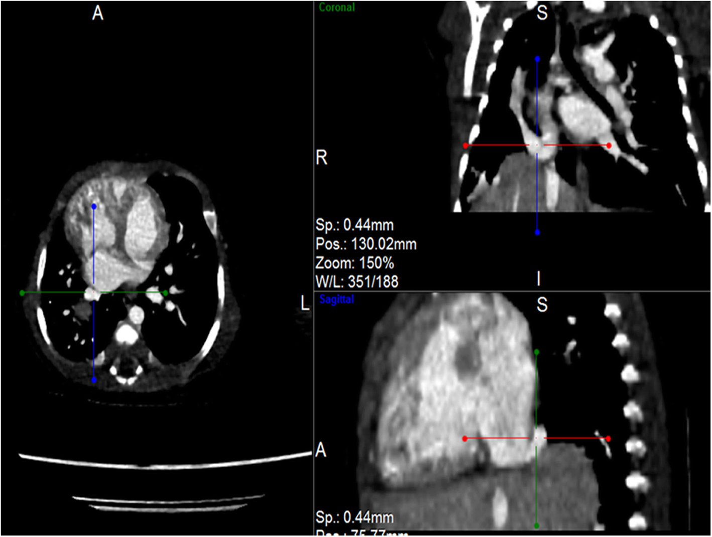 Fig. 2