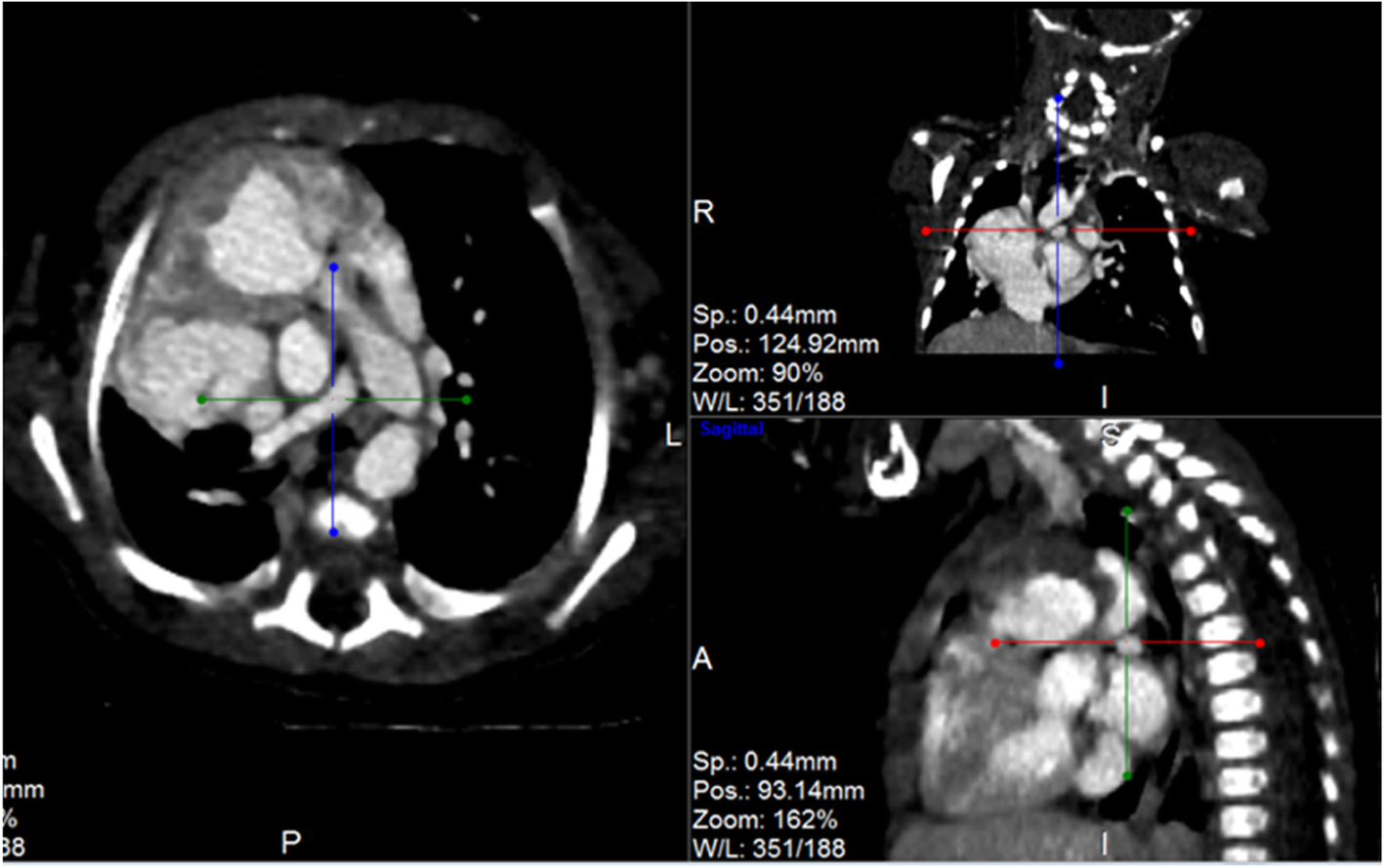 Fig. 4