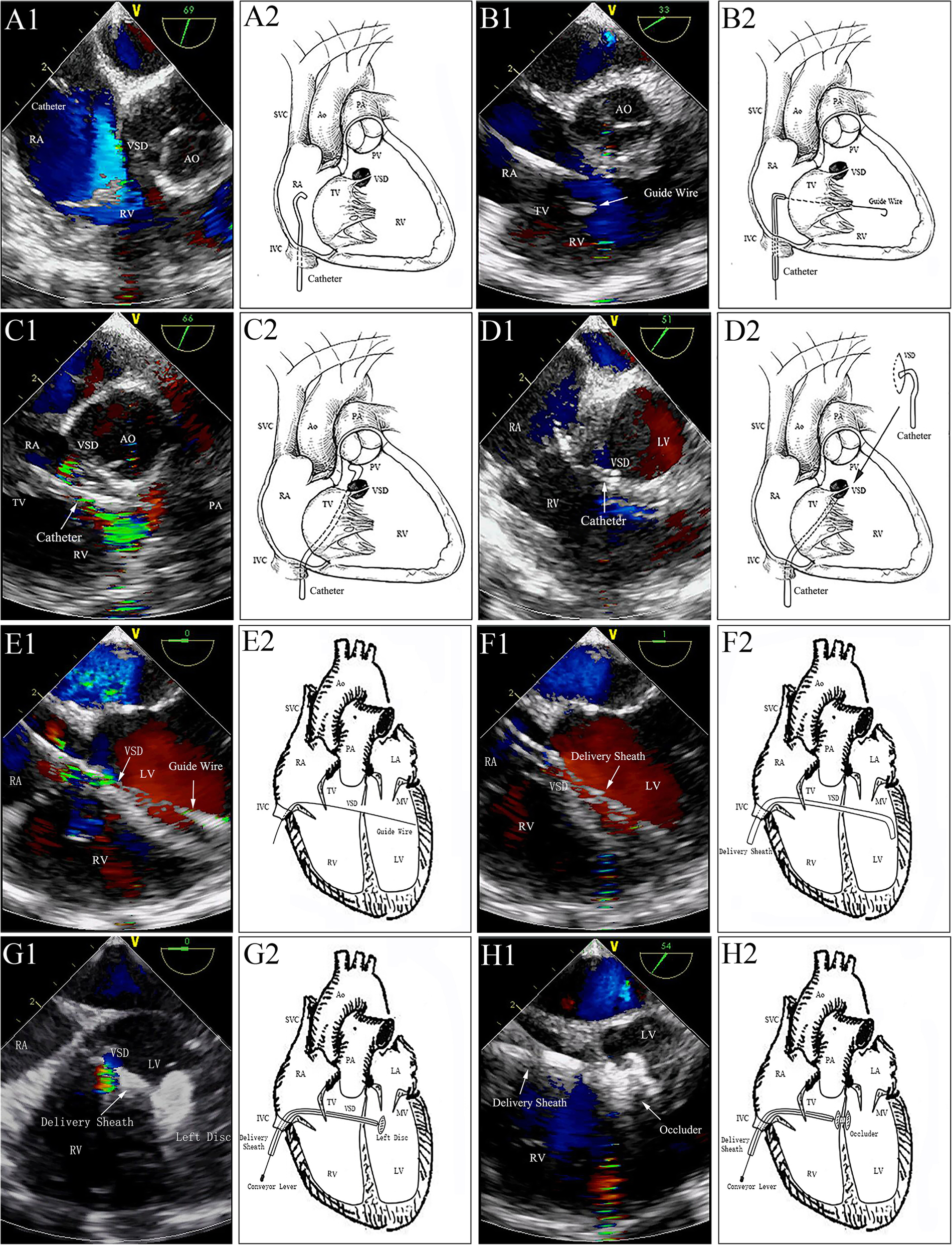 Fig. 2