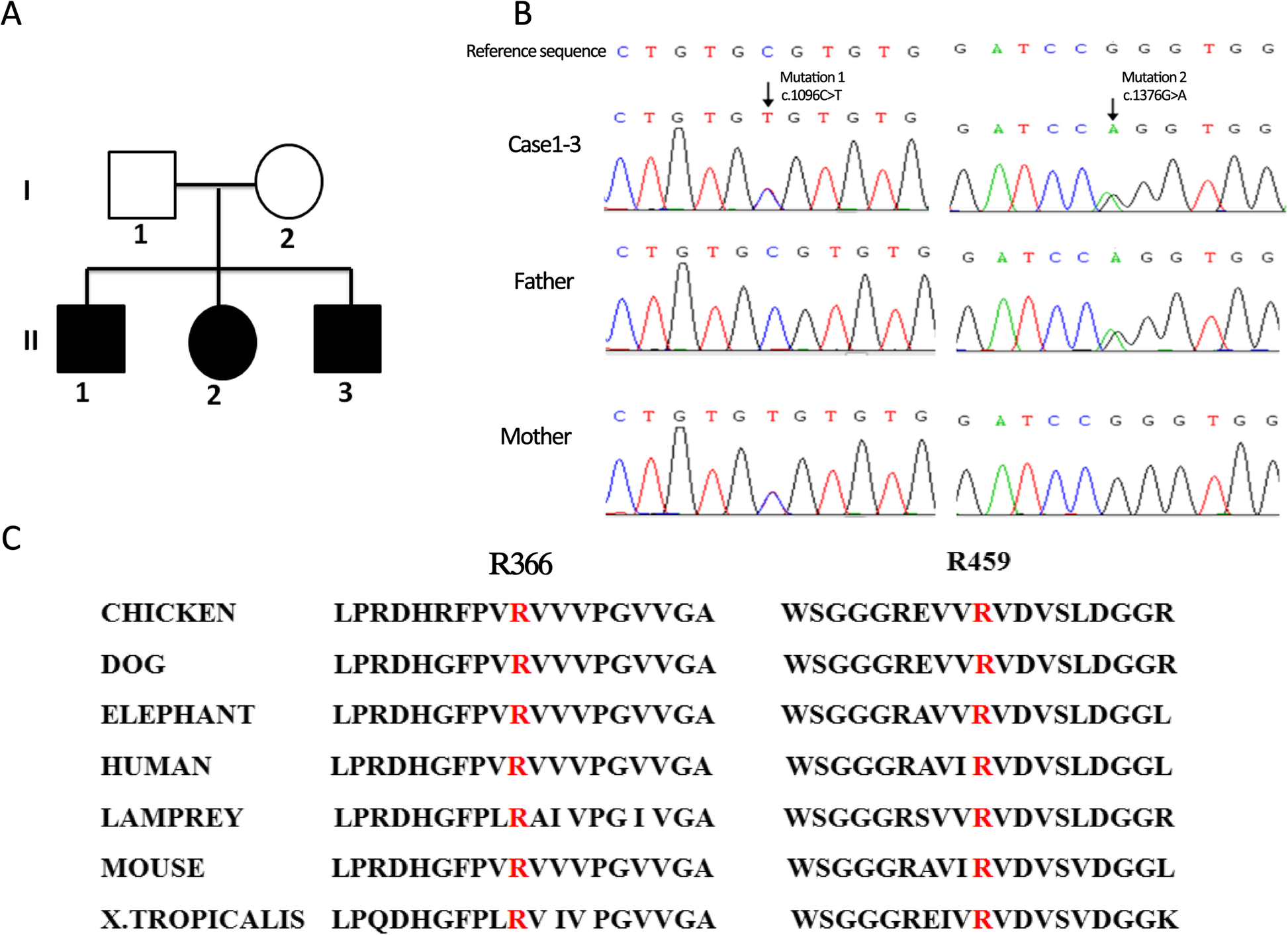 Stable Clinical Course In Three Siblings With Late Onset Isolated Sulfite Oxidase Deficiency A Case Series And Literature Review Bmc Pediatrics Full Text