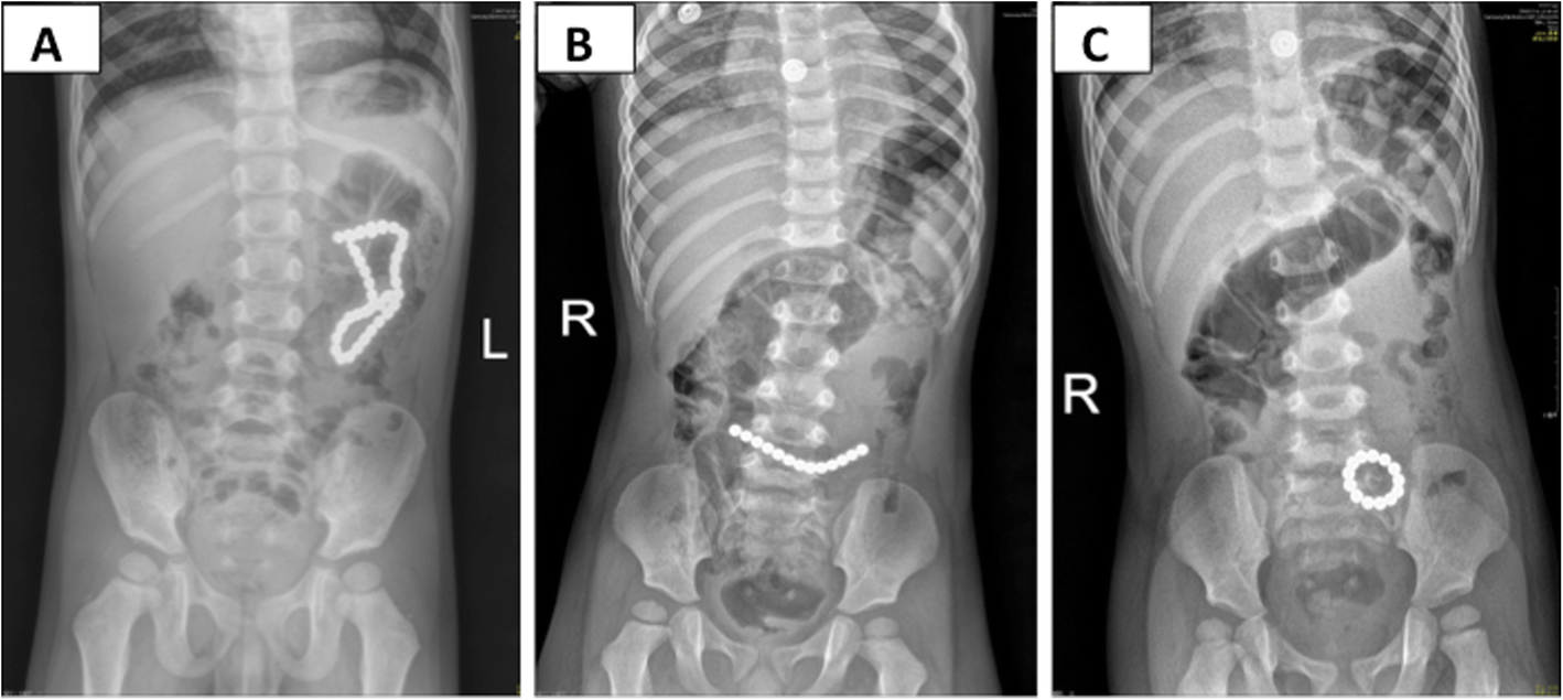 Fig. 2